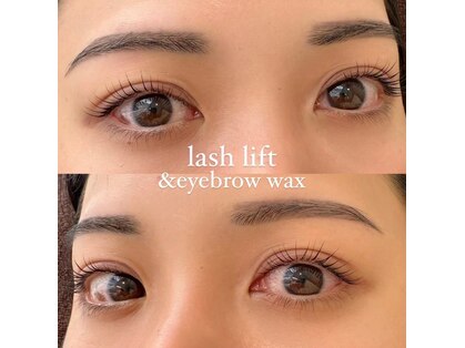 イーズ(ease.)の写真