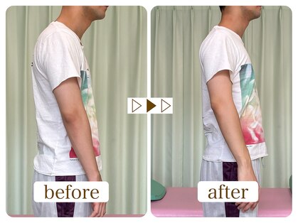 まっさ鍼灸整骨院 京王堀之内院の写真