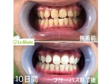 ルブラン 奈良店(Le Blanc)/貴方も変われます！