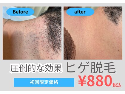 モルト(MOLT)の写真