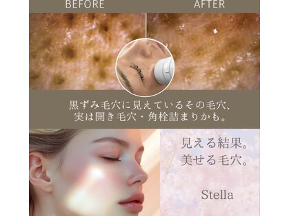 ステラ(Stella)の写真