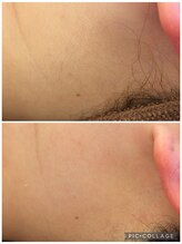 アンドエミニー エン ラボーテ(& EMINY 艶 la beaute)/美肌Wax脱毛