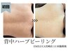 【ハーブピーリング背中】初回体験│艶感あるお背中に│選べるハーブ¥9600