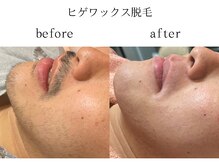 サロン ド アピール(salon de APPEAL)/