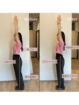 メイリリー(may lily)/◇施術イメージ　20代女性◇