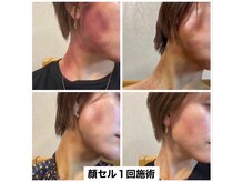 スピード美人 本八幡店/１回でこの変化