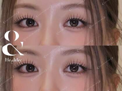 エイシェルの写真