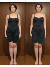 テマモリ(temamori)/施術ビフォーアフター