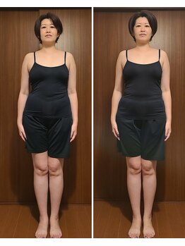 テマモリ(temamori)/施術ビフォーアフター