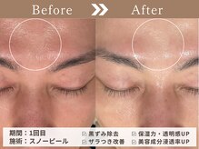 メンズもOK！剃刀負けなど男性特有のお悩みもお気軽に♪