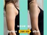 【Open記念】自信を持って出せる二の腕へ！脂肪分解（二の腕）24000