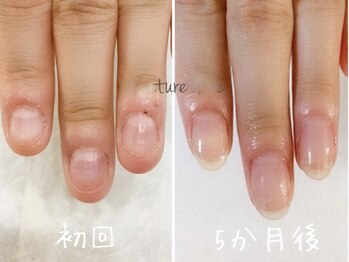 エール バイ クレアチュールドゥエ(ailes by creaturedoue)/お客様の育成経過