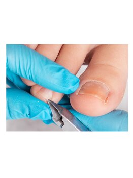 きぼう鍼灸整骨院/フットケア