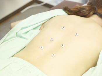 シフク鍼灸整体院/自律神経の乱れ