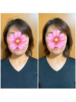 カイロプラクティック ネクサス/顔の歪み撃退☆