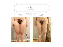 メゾンドフォレスト(Maison de Forest)の雰囲気（小顔・Vライン・美白・脂肪・シミケア・ブライダル・痩身）