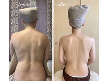 リュクス(Luxe)/ブライダル痩身　（30代)