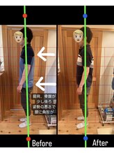 はまもと整骨院/整体・姿勢改善