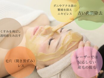 フィー(Fee)