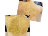 夏限定♪松ヤニパック倍量【背中70分】脱毛・黒ずみ・ニキビケア通常15,200