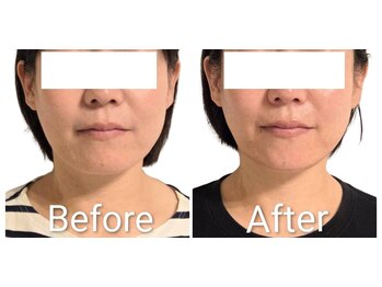 藍/レモンボトル