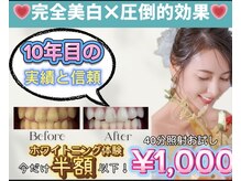 ホワイトニングショップ 越谷せんげん台店