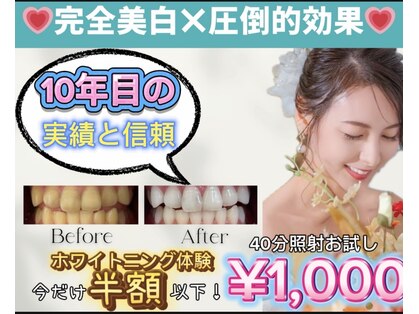 ホワイトニングショップ 越谷せんげん台店の写真