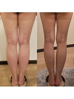トータルエステティック ジョワイユ(JOYEUX)/脚集中ケア