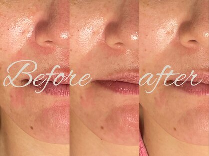 ゾーンビューティーハウス 柏店(ZONE BEAUTY HOUSE)の写真