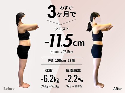 アンプシーフィット(UMPSY FIT)の写真