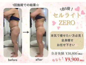 ナチュールファースト(naturel first)の写真/【短期間で変わりたい】1回でも変化実感◎全身スッキリ痩身コース