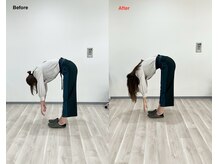 みずき/腰痛のビフォーアフター