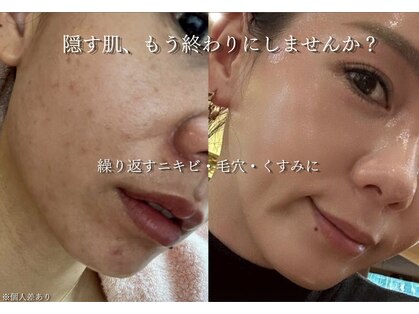 ココニー 天六店(Coconi)の写真