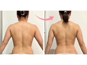 ルミエル 泉店(Lumiere)の写真/ガチガチコリのリセット＆むくみケアで理想の見た目痩せ！健康美をサポート！