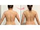 ルミエル 泉店(Lumiere)の写真/ガチガチコリのリセット＆むくみケアで理想の見た目痩せ！健康美をサポート！