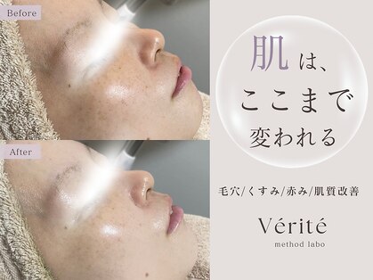 ヴェリテ(Verite)の写真
