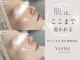ヴェリテ(Verite)の写真