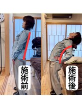 鍼灸整骨院ゼット(Z)&nbsp;腰痛改善 整体