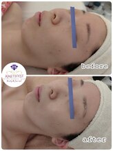 プライベートエステティックサロン アメジスト(AMETHYST)/継続のお手入れが効果的です。