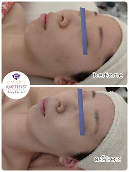 プライベートエステティックサロン アメジスト(AMETHYST)/継続のお手入れが効果的です。