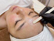 エイチラボ(H lab.)/脱毛【フェイシャルワックス】