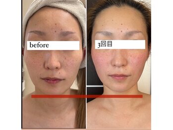 リラックススペース アーク(relax space Arc)/