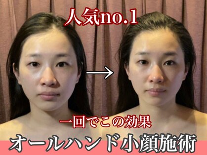 ティアラ(TIARA)の写真