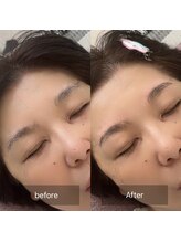 ハッピーアリスター(HAPPY ALISTER)/眉癖改善☆高さの違いの眉も◎