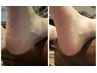 【再来】かかと角質ケア　ガサガサ→ふっくらへ!不要な角質脱ぎ捨て足元軽く!