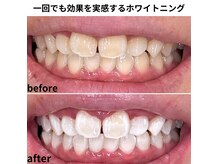ソエルテ(soerute)の雰囲気（【ホワイトニング】お客様満足度◎照射直後から着色の心配なし！）
