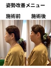 ひろ整骨院/姿勢改善メニュー