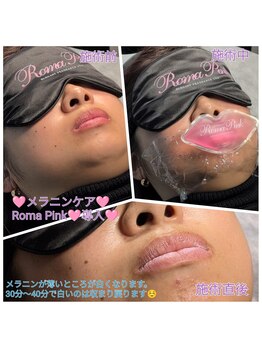 エステティックサロン やまとなでしこ/Roma Pink☆リップ施術中
