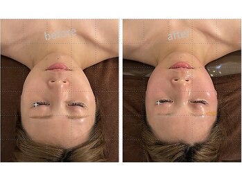 エムズプレミアム(M’s Premium)/小顔矯正&左右バランス調整