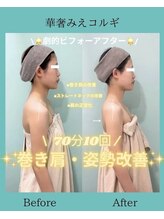 アコガレコガオ 鳥取店/コルギのビフォーアフター